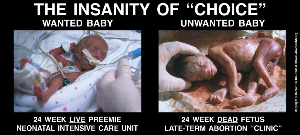 Bild från http://www.abortionno.org/