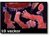 Abortbild - 10 veckor