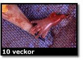 Abortbild - 10 veckor