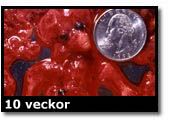 Abortbild - 10 veckor