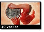 Abortbild - 10 veckor