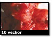 Abortbild - 10 veckor
