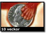 Abortbild - 10 veckor