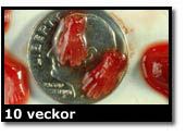 Abortbild - 10 veckor