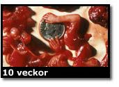 Abortbild - 10 veckor