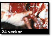 Abortbild - 22 veckor